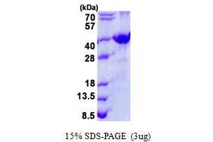 Image no. 1 for Frizzled-Related Protein (FRZB) protein (His tag) (ABIN1098735) (FRZB Protein (His tag))