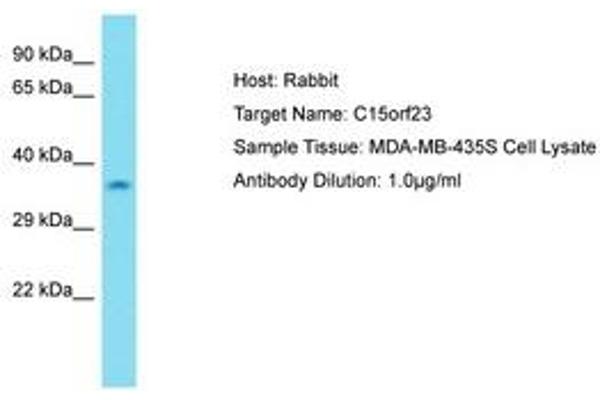 KNSTRN anticorps  (AA 31-80)