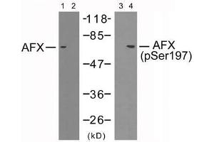 Western blot analysis of extracts from 293 cells using AFX (Ab-197) antibody (E021162, Lane 1 and 2) and AFX (phospho-Ser197) antibody (E011137, Lane 3 and 4). (FOXO4 anticorps)