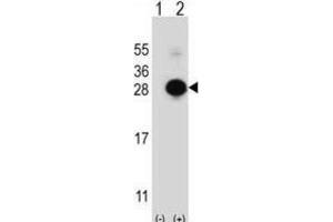 Western Blotting (WB) image for anti-MOB1, Mps One Binder Kinase Activator-Like 1B (MOBKL1B) antibody (ABIN3003175) (MOB1A anticorps)