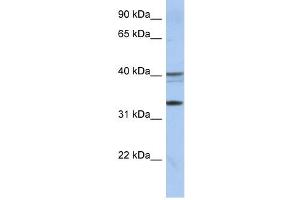 TEX264 antibody used at 1 ug/ml to detect target protein. (TEX264 anticorps  (Middle Region))