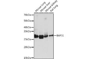 Western blot analysis of extracts of various cell lines, using B Rabbit mAb (ABIN1680181, ABIN7101458, ABIN7101459 and ABIN7101460) at 1:1000 dilution. (BCAP31 anticorps)