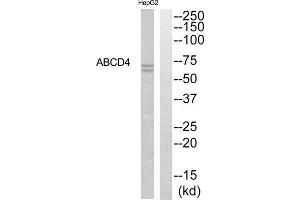 Western Blotting (WB) image for anti-ATP-Binding Cassette, Sub-Family D (Ald), Member 4 (ABCD4) (Internal Region) antibody (ABIN1850849) (ABCD4 anticorps  (Internal Region))