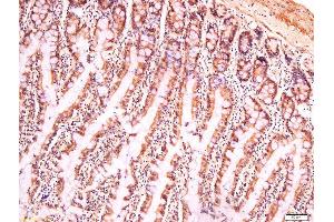 Immunohistochemistry (Paraffin-embedded Sections) (IHC (p)) image for anti-NLR Family, Pyrin Domain Containing 3 (NLRP3) (AA 15-120) antibody (ABIN1386361)