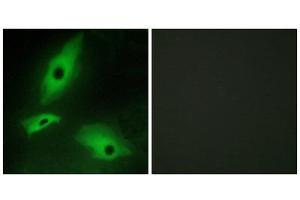 Immunofluorescence (IF) image for anti-Lymphotoxin beta Receptor (TNFR Superfamily, Member 3) (LTBR) (N-Term) antibody (ABIN1849343) (LTBR anticorps  (N-Term))