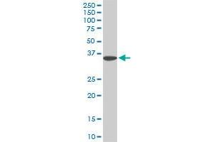 Western Blotting (WB) image for anti-Four and A Half LIM Domains 1 (FHL1) (AA 23-120) antibody (ABIN560899)