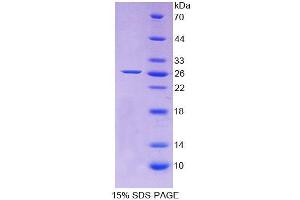 SDS-PAGE analysis of Rat Apolipoprotein A5 Protein. (APOA5 Protéine)