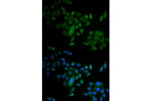 Immunofluorescence analysis of A549 cells using CASP9 antibody. (Caspase 9 anticorps)