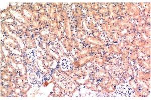 Immunohistochemistry of paraffin-embedded Mouse kidney tissue using Bax Monoclonal Antibody at dilution of 1:200. (BAX anticorps)
