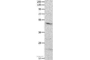 Western blot analysis of Mouse brain tissue, using GNAS Polyclonal Antibody at dilution of 1:500 (GNAS anticorps)