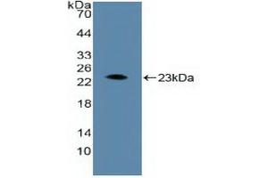 Detection of Recombinant ARNT, Human using Polyclonal Antibody to Aryl Hydrocarbon Receptor Nuclear Translocator (ARNT) (ARNT anticorps  (AA 624-789))