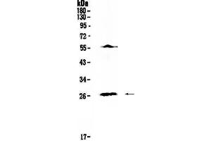 Western blot analysis of IL17 using anti-IL17 antibody . (Interleukin 17a anticorps  (AA 26-158))