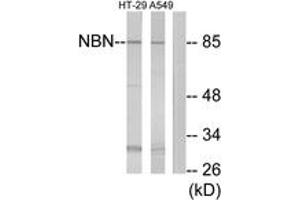 Western Blotting (WB) image for anti-Nibrin (NBN) (AA 431-480) antibody (ABIN2890017) (Nibrin anticorps  (AA 431-480))