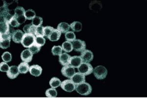 Immunofluorescence staining of PC12 cells (Rat neuroblastoma, ATCC CRL-1721) treated with NGF. (GNAQ anticorps  (AA 22-31))