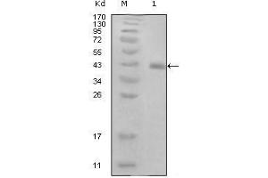 HPV16 E7 anticorps