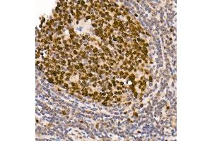 Immunohistochemistry of paraffin-embedded human tonsil using [KO Validated] DNMT1 Rabbit mAb (ABIN7266808) at dilution of 1:100 (40x lens). (DNMT1 anticorps)