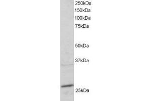 ABIN2564836 staining (2µg/ml) of mouse heart lysate (RIPA buffer, 30µg total protein per lane). (RAB11A anticorps  (C-Term))