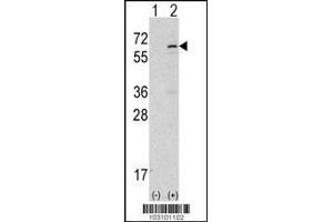 Image no. 1 for anti-tyrosine Kinase, Non-Receptor, 2 (TNK2) (AA 934-964) antibody (ABIN2451837) (TNK2 anticorps  (AA 934-964))
