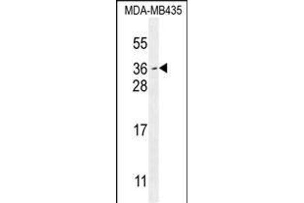 Myc Target 1 anticorps  (C-Term)