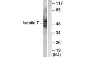 Western blot analysis of extracts from HepG2 cells, using Keratin 7 Antibody. (Cytokeratin 7 anticorps  (AA 420-469))