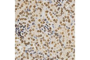 Immunohistochemistry (IHC) image for anti-Lamin A/C (LMNA) (AA 403-572) antibody (ABIN3020785)