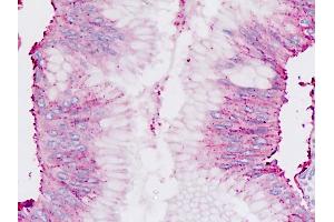 Human Pancreas: Formalin-Fixed, Paraffin-Embedded (FFPE) (Chordin anticorps  (C-Term))