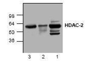 Image no. 1 for anti-Histone Deacetylase 2 (HDAC2) antibody (ABIN127234) (HDAC2 anticorps)