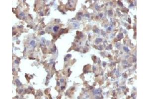 Immunohistochemistry (Formalin-fixed Paraffin-embedded Sections) (IHC (fp)) image for anti-Tumor Necrosis Factor alpha (TNF alpha) antibody (ABIN3023860)