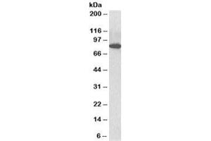Western blot testing of C57/B6 mouse CTL lysate with ODF2 antibody at 3ug/ml. (ODF2 anticorps)