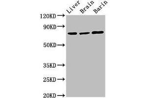 Western Blot Positive WB detected in: Rat liver tissue, Rat brain tissue, Mouse brain tissue All lanes: Hspa5 antibody at 3 μg/mL Secondary Goat polyclonal to rabbit IgG at 1/50000 dilution Predicted band size: 73 kDa Observed band size: 73 kDa (GRP78 anticorps  (AA 20-655))