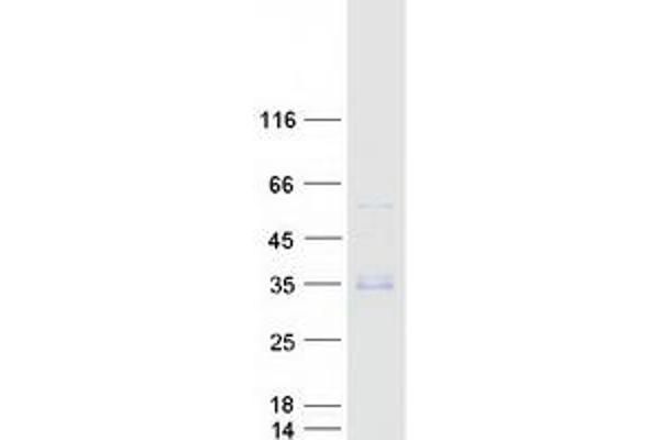 WFDC3 Protein (Myc-DYKDDDDK Tag)