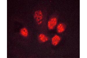 ABIN6267495 staining Hela cells by ICC/IF. (PPARG anticorps  (pSer112))
