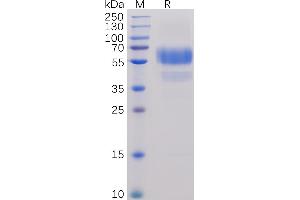 Human CD70 Protein, hFc-His Tag on SDS-PAGE under reducing condition. (CD70 Protein (AA 39-193) (Fc-His Tag))