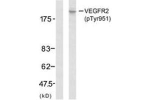 Western Blotting (WB) image for anti-VEGF Receptor 2 (VEGFR2) (pTyr951) antibody (ABIN2888557) (VEGFR2/CD309 anticorps  (pTyr951))