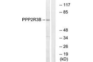 Western blot analysis of extracts from K562 cells, using PPP2R3B Antibody. (PPP2R3B anticorps  (AA 364-413))