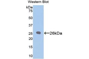 Detection of Recombinant Bcl2, Rat using Polyclonal Antibody to B-Cell Leukemia/Lymphoma 2 (Bcl2) (Bcl-2 anticorps  (AA 2-208))