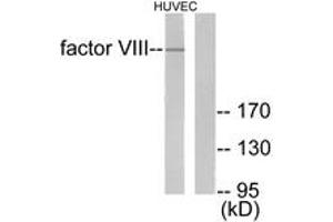 Western blot analysis of extracts from HuvEc cells, using Factor VIII Antibody. (Factor VIII anticorps  (AA 2161-2210))