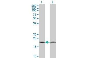 Western Blot analysis of PTH expression in transfected 293T cell line by PTH monoclonal antibody (M18), clone 3C2. (PTH anticorps  (AA 32-115))