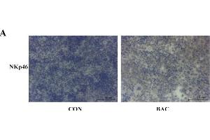 Immunohistochemistry (IHC) image for anti-Integrin alpha M (ITGAM) (AA 520-570) antibody (ABIN741285)