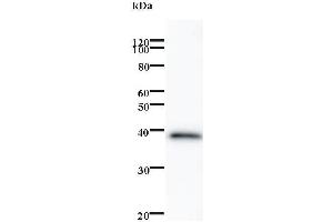 Western Blotting (WB) image for anti-Zinc finger protein ubi-d4 (DPF2) antibody (ABIN932486) (DPF2 anticorps)