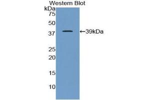 Western blot analysis of the recombinant protein. (APOC1 anticorps  (AA 34-88))