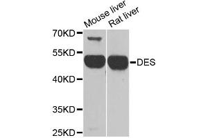 Western blot analysis of extracts of various cell lines, using DES antibody (ABIN1872252) at 1:1000 dilution. (Desmin anticorps)