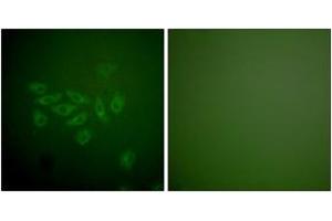 Immunofluorescence analysis of A549 cells, using FHIT Antibody. (FHIT anticorps  (AA 81-130))