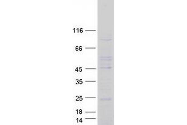 LHFP Protein (Myc-DYKDDDDK Tag)