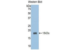 Western Blotting (WB) image for anti-Transcription Factor 20 (TCF20) (AA 392-524) antibody (ABIN1860690) (TCF20 anticorps  (AA 392-524))