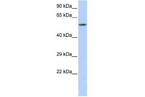 CACNB1 antibody used at 1 ug/ml to detect target protein. (CACNB1 anticorps  (C-Term))