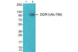 Western blot analysis of extracts from JK cells (Lane 2), using DDR1 (Ab-796) antiobdy. (DDR1 anticorps  (Tyr796))