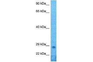 Host:  Rabbit  Target Name:  PRRX1  Sample Type:  Hela Whole Cell lysates  Antibody Dilution:  1. (PRRX1 anticorps  (N-Term))