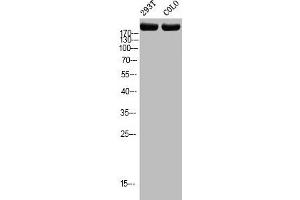 Western blot analysis of 293T COLO using p-Topo IIα (T1343) antibody. (Topoisomerase II alpha anticorps  (pSer1343))