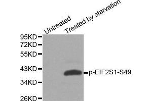 Western blot analysis of extracts from Hela cells, using phospho-EIF2S1-S49 antibody. (EIF2S1 anticorps  (pSer49))